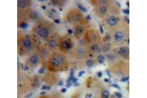 IHC-P analysis of Liver tissue, with DAB staining. (HYAL2 Antikörper  (AA 23-447))