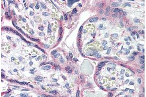 Anti-CXCR1 antibody  ABIN1048470 IHC staining of human placenta. (CXCR1 Antikörper  (Internal Region))