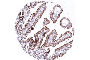 Duodenum exhibiting significant granular cytoplasmic SDHB staining in epithelial cells predominantly in the sub apical cell compartments (Rekombinanter SDHB Antikörper)