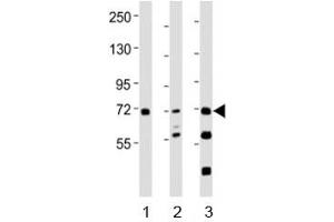 Western blot testing of SYK antibody at 1:2000 dilution. (SYK Antikörper  (AA 268-305))