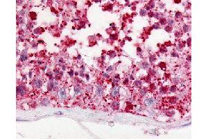 Immunohistochemical (Formalin/PFA-fixed paraffin-embedded sections) staining in human testis with GPR18 polyclonal antibody . (GPR18 Antikörper)
