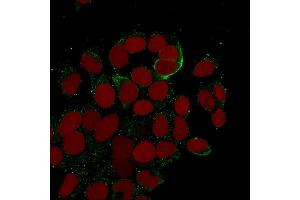 Immunofluorescent analysis of MeOH-fixed MCF-7 cells using Cytokeratin 10/13 Mouse Monoclonal Antibody (DE-K13) followed by goat anti-mouse IgG-CF488. (KRT10, KRT13 Antikörper)