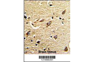 Formalin-fixed and paraffin-embedded human brain tissue reacted with ND5 Antibody , which was peroxidase-conjugated to the secondary antibody, followed by DAB staining. (MT-ND5 Antikörper  (C-Term))
