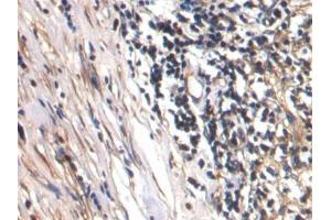 DAB staining on IHC-P; Samples: Human Lymph node Tissue