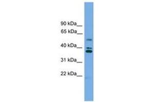 Image no. 1 for anti-Low Density Lipoprotein Receptor Class A Domain Containing 3 (LDLRAD3) (AA 143-192) antibody (ABIN6745022) (LDLRAD3 Antikörper  (AA 143-192))