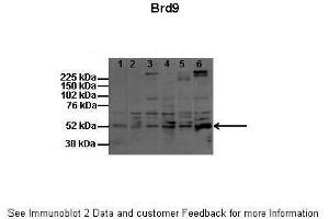 Lanes:   1: 60ug mouse melanocytes (melba), 2: 60ug mouse melanoma (B16), 3: 60ug human melanocytes (HFSC), 4: 60ug human melanoma (SK-MEL5), 5: 60ug human melanoma (YUMAC), 6: 60ug rat shwann cell  Primary Antibody Dilution:   1:200  Secondary Antibody:   Donkey anti-rabbit HPRT  Secondary Antibody Dilution:   1:2000  Gene Name:   BRD9  Submitted by:   Dr. (BRD9 Antikörper  (N-Term))