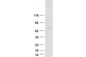 HHAT Protein (Transcript Variant 1) (Myc-DYKDDDDK Tag)