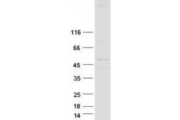 HHAT Protein (Transcript Variant 1) (Myc-DYKDDDDK Tag)