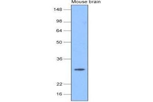 The extracts of mouse brain (20 ug) were resolved by SDS-PAGE, transferred to nitrocellulose membrane and probed with anti-human PGP9.