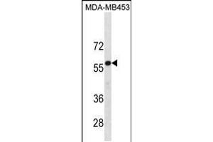 Western blot analysis in MDA-MB453 cell line lysates (35ug/lane). (UGT2B4 Antikörper  (N-Term))