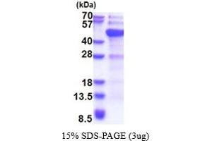 SDS-PAGE (SDS) image for DNA (Cytosine-5-)-Methyltransferase 3 Like (TRDMT1) (AA 1-386) protein (His tag) (ABIN5853724) (DNMT3L Protein (AA 1-386) (His tag))