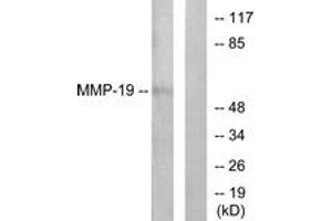 Western Blotting (WB) image for anti-Matrix Metallopeptidase 19 (MMP19) (AA 11-60) antibody (ABIN2889231) (MMP19 Antikörper  (AA 11-60))