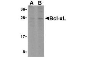 Western blot analysis of Bcl-xL in A549 cell lysates with AP30132PU-N Bcl-xL antibody at (A) 1 and (B) 2 μg/ml. (BCL2L1 Antikörper)