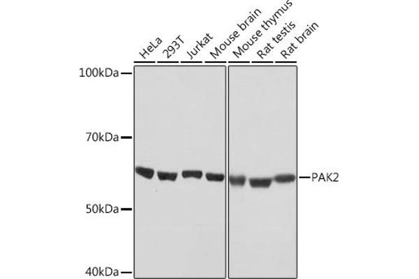PAK2 anticorps