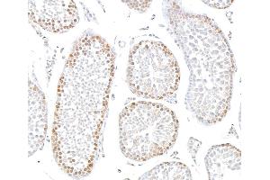 Immunohistochemistry (IHC) image for anti-Sp1 Transcription Factor (SP1) (AA 250-300) antibody (ABIN7795788)