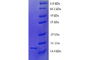 SDS-PAGE (SDS) image for Tetraspanin 7 (TSPAN7) (AA 113-223), (Extracellular) protein (His tag) (ABIN5710556) (Tetraspanin 7 Protein (TSPAN7) (AA 113-223, Extracellular) (His tag))