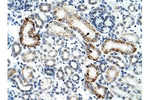 ZRSR2 antibody was used for immunohistochemistry at a concentration of 4-8 ug/ml to stain Epithelial cells of renal tubule (arrows) in Human Kidney. (ZRSR2 Antikörper)
