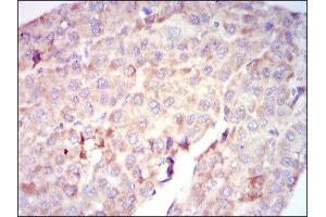 Immunohistochemistry (IHC) image for anti-V-Raf-1 Murine Leukemia Viral Oncogene Homolog 1 (RAF1) antibody (ABIN1844891) (RAF1 Antikörper)