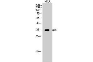 Western Blotting (WB) image for anti-P35 (N-Term) antibody (ABIN3176715) (P35 (N-Term) Antikörper)
