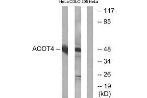Western Blotting (WB) image for anti-Acyl-CoA Thioesterase 4 (ACOT4) (C-Term) antibody (ABIN1850684) (ACOT4 Antikörper  (C-Term))