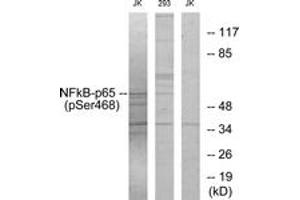Western Blotting (WB) image for anti-Nuclear Factor-kB p65 (NFkBP65) (pSer468) antibody (ABIN2888488) (NF-kB p65 Antikörper  (pSer468))