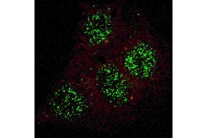 Fluorescent confocal image of HepG2 cells stained with phospho-GATA6- antibody.