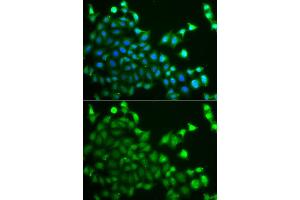 Immunofluorescence analysis of A549 cell using CBLC antibody. (CBLC Antikörper)