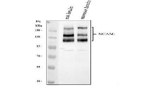Western blot analysis of NCAM1 using anti-NCAM1 antibody (ABIN7600132). (CD56 Antikörper  (AA 152-690))