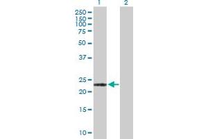 Western Blot analysis of ARL11 expression in transfected 293T cell line by ARL11 MaxPab polyclonal antibody. (ARL11 Antikörper  (AA 1-196))