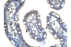 STAU1 antibody was used for immunohistochemistry at a concentration of 4-8 ug/ml to stain Epithelial cells of intestinal villus (arrows) in Human Intestine. (STAU1/Staufen Antikörper)