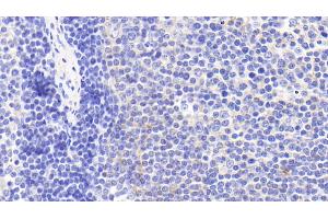 Detection of CHRM4 in Human Lymph node Tissue using Polyclonal Antibody to Cholinergic Receptor, Muscarinic 4 (CHRM4) (CHRM4 Antikörper)