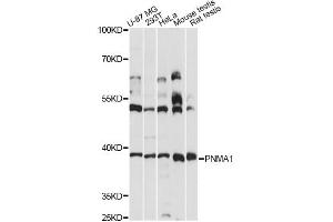 Western blot analysis of extracts of various cell lines, using PNMA1 antibody (ABIN6291181) at 1:3000 dilution.