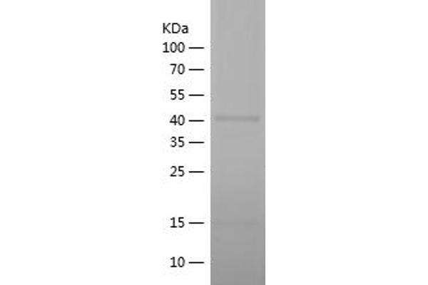 TPX2 Protein (AA 217-454) (His-IF2DI Tag)