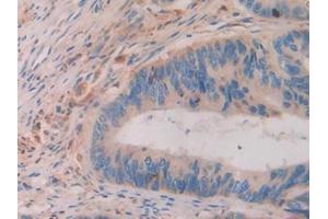 Immunohistochemistry (IHC) image for anti-Activating Transcription Factor 4 (Tax-Responsive Enhancer Element B67) (ATF4) (AA 130-347) antibody (ABIN7433582)