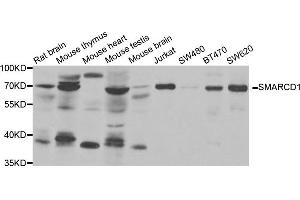 Western Blotting (WB) image for anti-SWI/SNF Related, Matrix Associated, Actin Dependent Regulator of Chromatin, Subfamily D, Member 1 (SMARCD1) antibody (ABIN1980326) (SMARCD1 Antikörper)