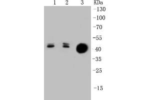 Lane 1: Lovo Cell lysates, Lane 2: HCT116 Cell lysates, Lane 3: CRC lysates, probed with Cytokeratin 20 (1F10) Monoclonal Antibody  at 1:1000 overnight at 4˚C. (KRT20 Antikörper)
