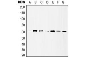 Western blot analysis of Histone Deacetylase 1 expression in MCF7 (A), HeLa (B), A431 (C), Jurkat (D), NIH3T3 (E), mouse lung (F), rat heart (G) whole cell lysates. (HDAC1 Antikörper  (C-Term))