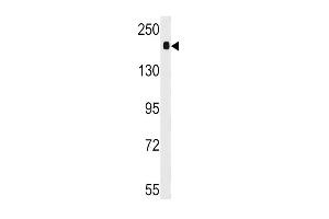 Western blot analysis of anti-ACE Antibody (C-term) (ABIN392223 and ABIN2841917) in mouse lung tissue lysates (35 μg/lane).