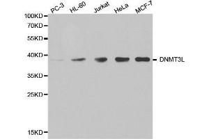 Western blot analysis of extracts of various cell lines, using DNMT3L antibody. (DNMT3L Antikörper  (AA 1-386))