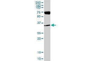 LDHA MaxPab rabbit polyclonal antibody. (Lactate Dehydrogenase A Antikörper  (AA 1-332))