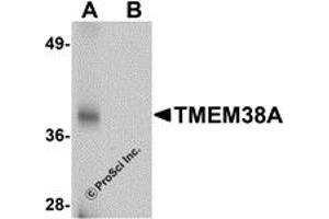Western Blotting (WB) image for anti-Transmembrane Protein 38A (TMEM38A) (C-Term) antibody (ABIN1030754) (TMEM38A Antikörper  (C-Term))