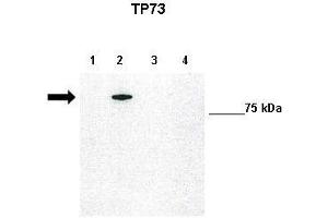 WB Suggested Anti-TP73 Antibody    Positive Control:  Lane1: 10ug untransfected H1299, Lane2: 10ug GFP-TAp73 transfected H1299, Lane3: 10ug GFP-DNp73 transfected H1299, Lane4: 10ug GFP-DBDp73 transfected H1299   Primary Antibody Dilution :   1:1000  Secondary Antibody :   Anti-rabbit-HRP   Secondry Antibody Dilution :   1:5000  Submitted by:  Francesca Grespi, VIB-Department for Molecular Biomedical Research, University of Gent (Tumor Protein p73 Antikörper  (N-Term))