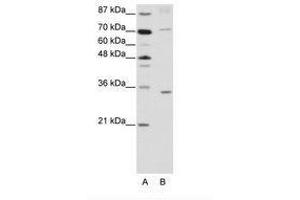 Image no. 1 for anti-Atonal Homolog 8 (ATOH8) (N-Term) antibody (ABIN202235) (ATOH8 Antikörper  (N-Term))