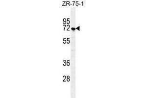 SUSD5 Antibody (C-term) western blot analysis in ZR-75-1 cell line lysates (35 µg/lane). (SUSD5 Antikörper  (C-Term))