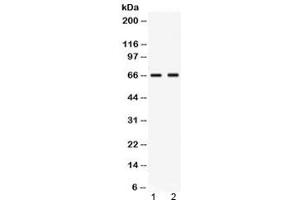 Western blot testing of human 1) MCF7 and 2) MM453 lysate with Nectin-4 antibody at 0. (PVRL4 Antikörper  (AA 53-94))