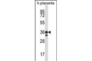 Mouse Mst4 Antibody (Center) (ABIN657993 and ABIN2846939) western blot analysis in human placenta tissue lysates (35 μg/lane). (STK26/MST4 Antikörper  (AA 271-299))