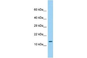 Host: Rabbit Target Name: LEPROTL1 Sample Type: Fetal Liver lysates Antibody Dilution: 1. (LEPROTL1 Antikörper  (N-Term))