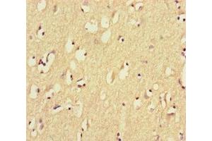 Immunohistochemistry of paraffin-embedded human brain tissue using ABIN7164461 at dilution of 1:100 (GPR156 Antikörper  (AA 614-814))