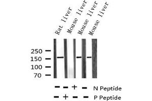 Western blot analysis of Phospho-EGFR (Tyr1110) expression in various lysates