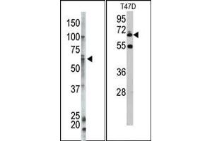 Image no. 1 for anti-Ubiquilin 1 (UBQLN1) (N-Term) antibody (ABIN357617) (Ubiquilin 1 Antikörper  (N-Term))